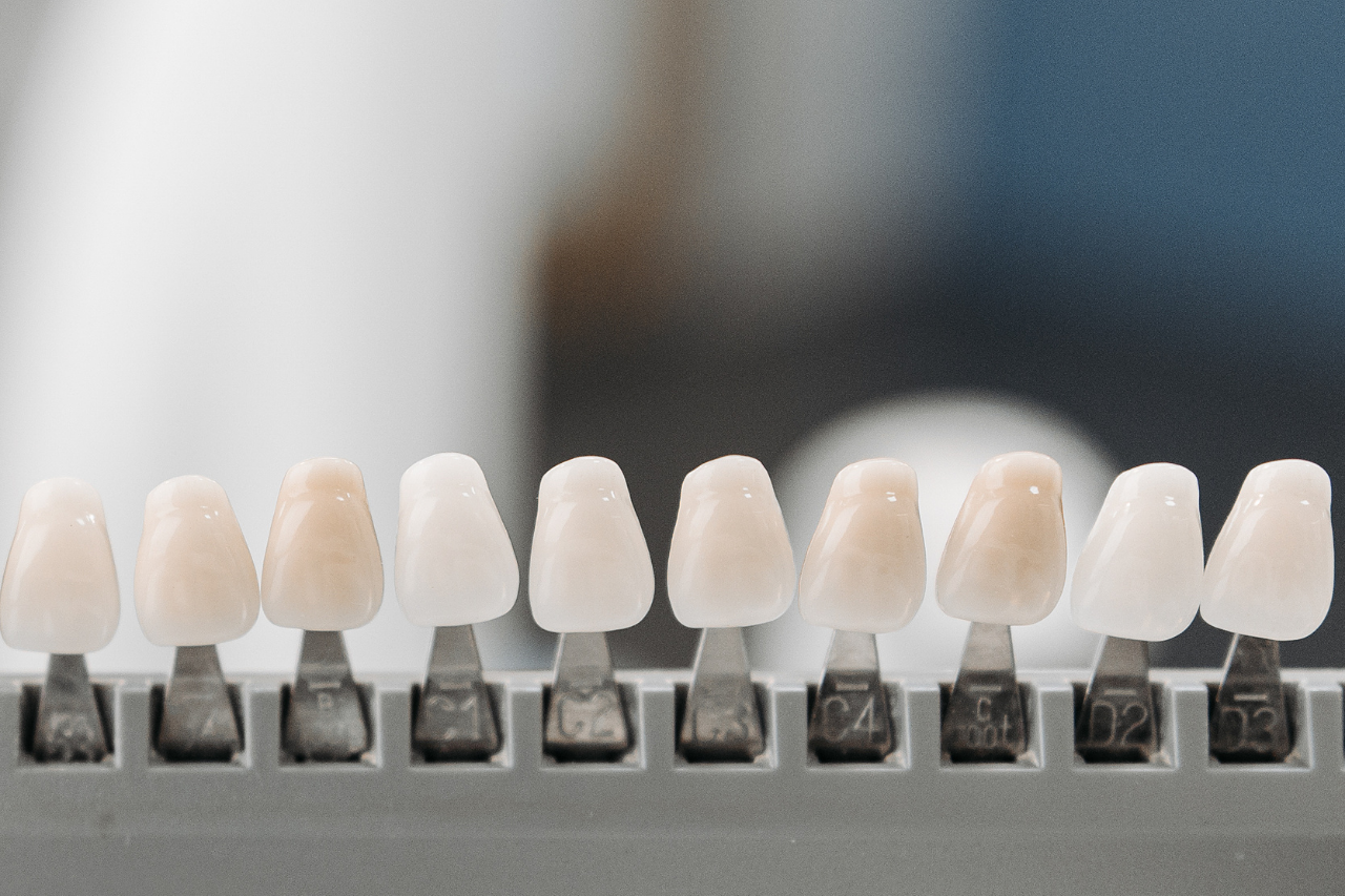 Veneers and Hollywood Smile icon